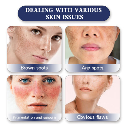 Skin Genesis Spot Whitening Cream, Dilute Spots Smooth Skin Bright White Color This Delicate Skin Moisturizing Cream Health Eprolo https://www.cyberehub.com