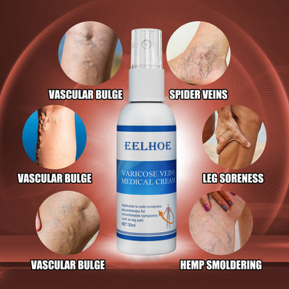 Intravenous Massage Spray For Varicose Veins Relief And Earthworm Leg Blood Vessel Bulge Pain Spray Health Eprolo https://www.cyberehub.com