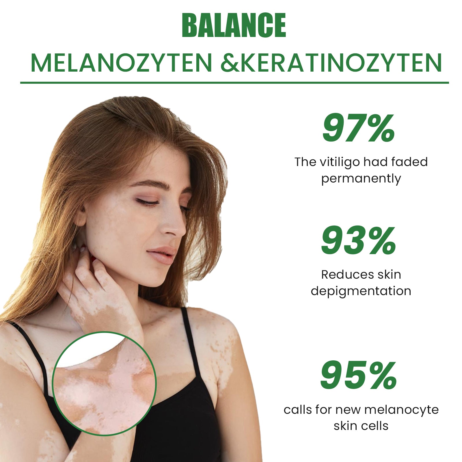 White Spot Repair Cream Skin White Spot Melanin Repair Even Skin Tone Topical Care Cream Health & Beauty Health Eprolo https://www.cyberehub.com