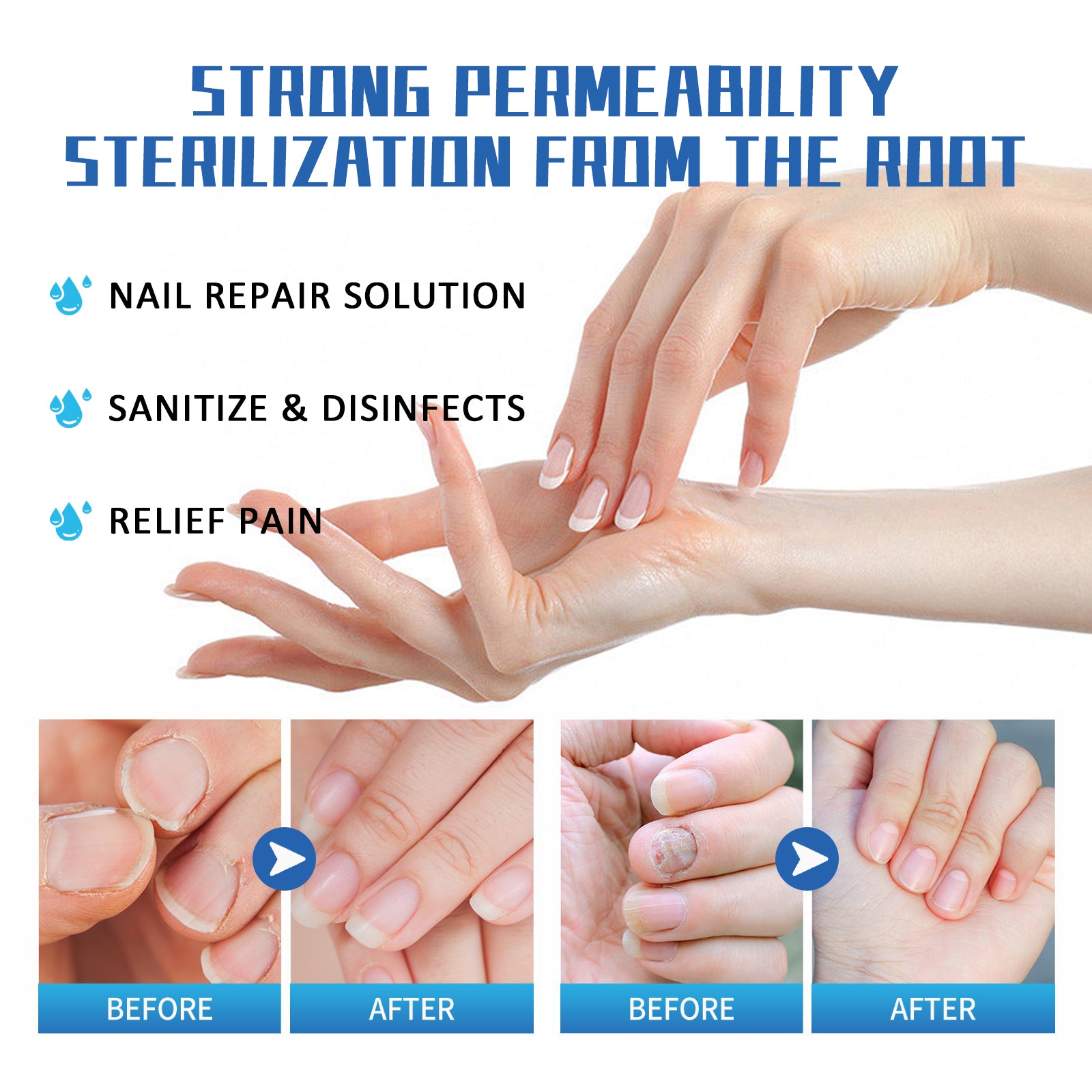 Nail Fungus Treatment Method, Repair Grey Nail Brightening Nail Thickening Nail Hand And Foot Nails Moisturizing Care Cream Health Eprolo https://www.cyberehub.com