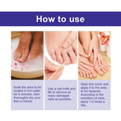Nail Repair Lotion, Repair Thickening Nail Inlay Gray Nail Shine Soft Nail Care Solution Health Eprolo https://www.cyberehub.com