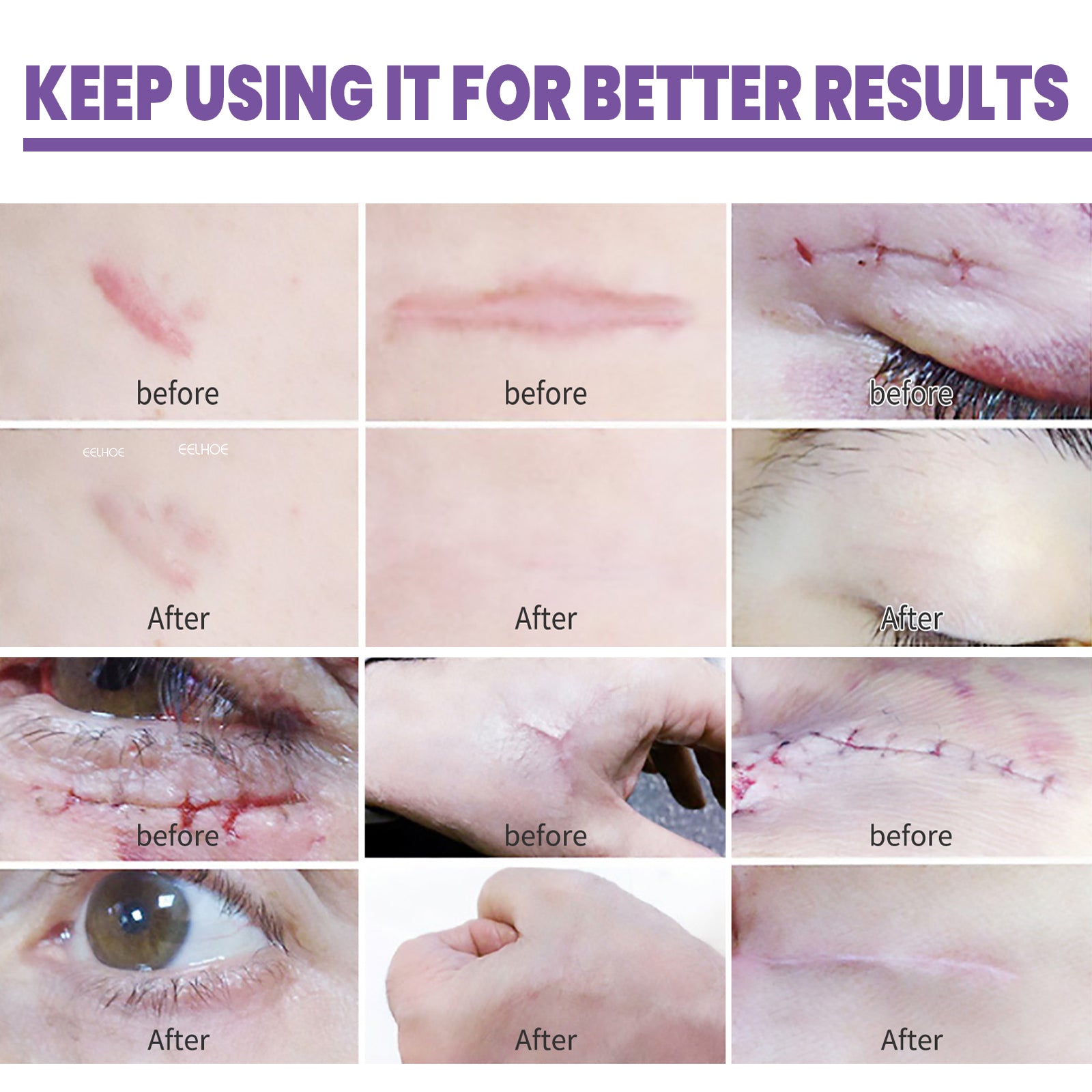 Skin Care Cream, Daily Moisturizing, Smoothing And Firming Skin Repair Postpartum Repair Topical Cream Health Eprolo https://www.cyberehub.com