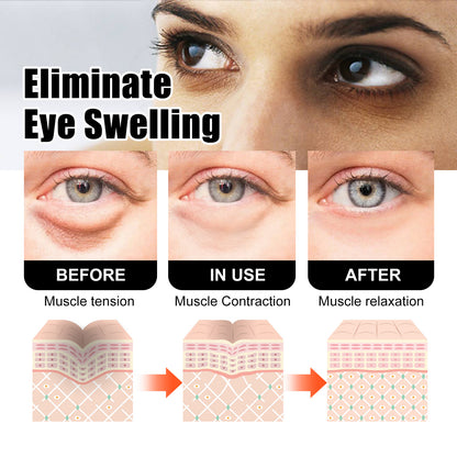 Snake Venom Peptide Eye Cream Gently Nourishes Skin, Reduces Fine Lines, Hydrates And Moisturizes Eye Cream Health Eprolo https://www.cyberehub.com