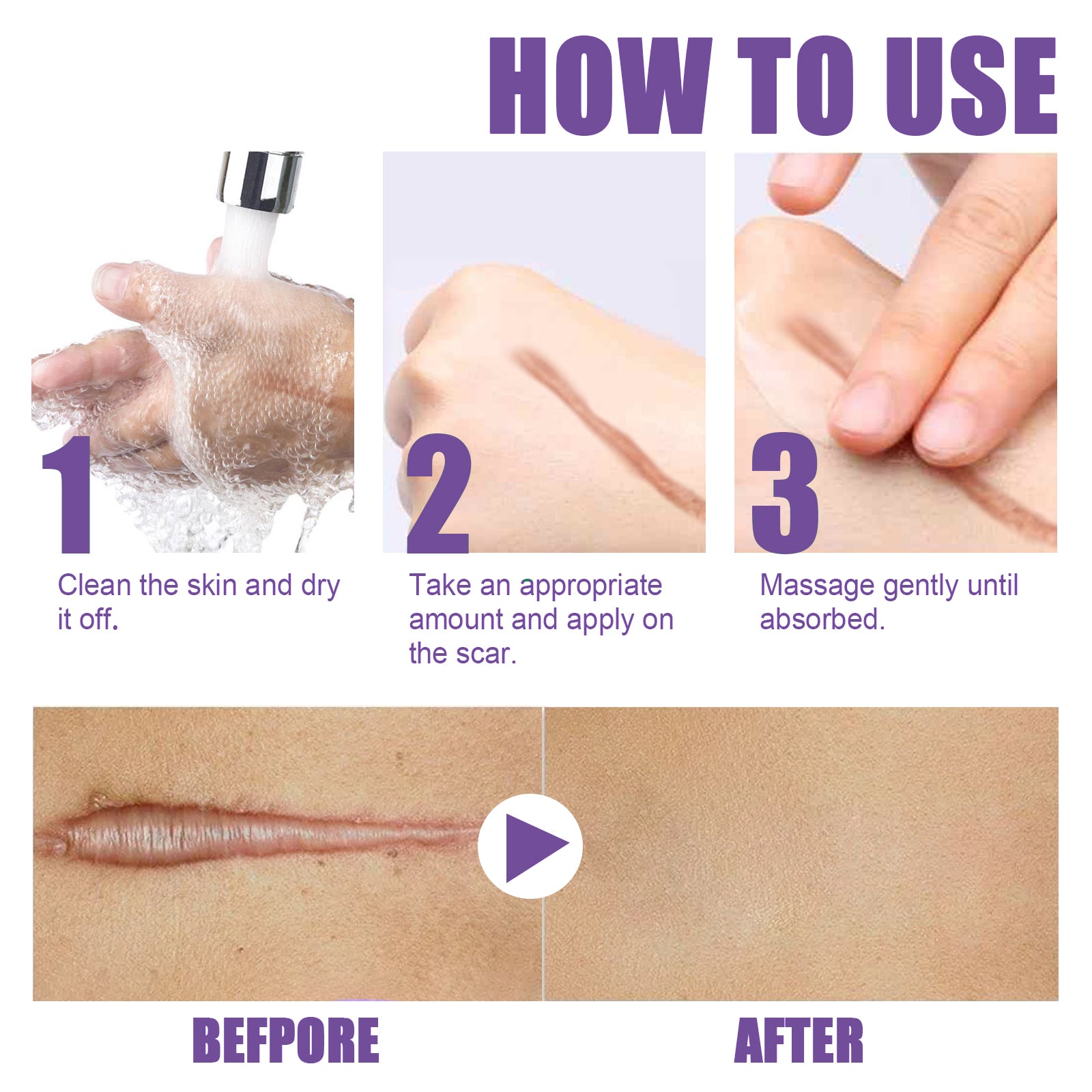 Skin Care Cream, Daily Moisturizing, Smoothing And Firming Skin Repair Postpartum Repair Topical Cream Health Eprolo https://www.cyberehub.com