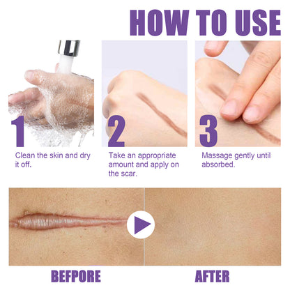 Skin Care Cream, Daily Moisturizing, Smoothing And Firming Skin Repair Postpartum Repair Topical Cream Health Eprolo https://www.cyberehub.com