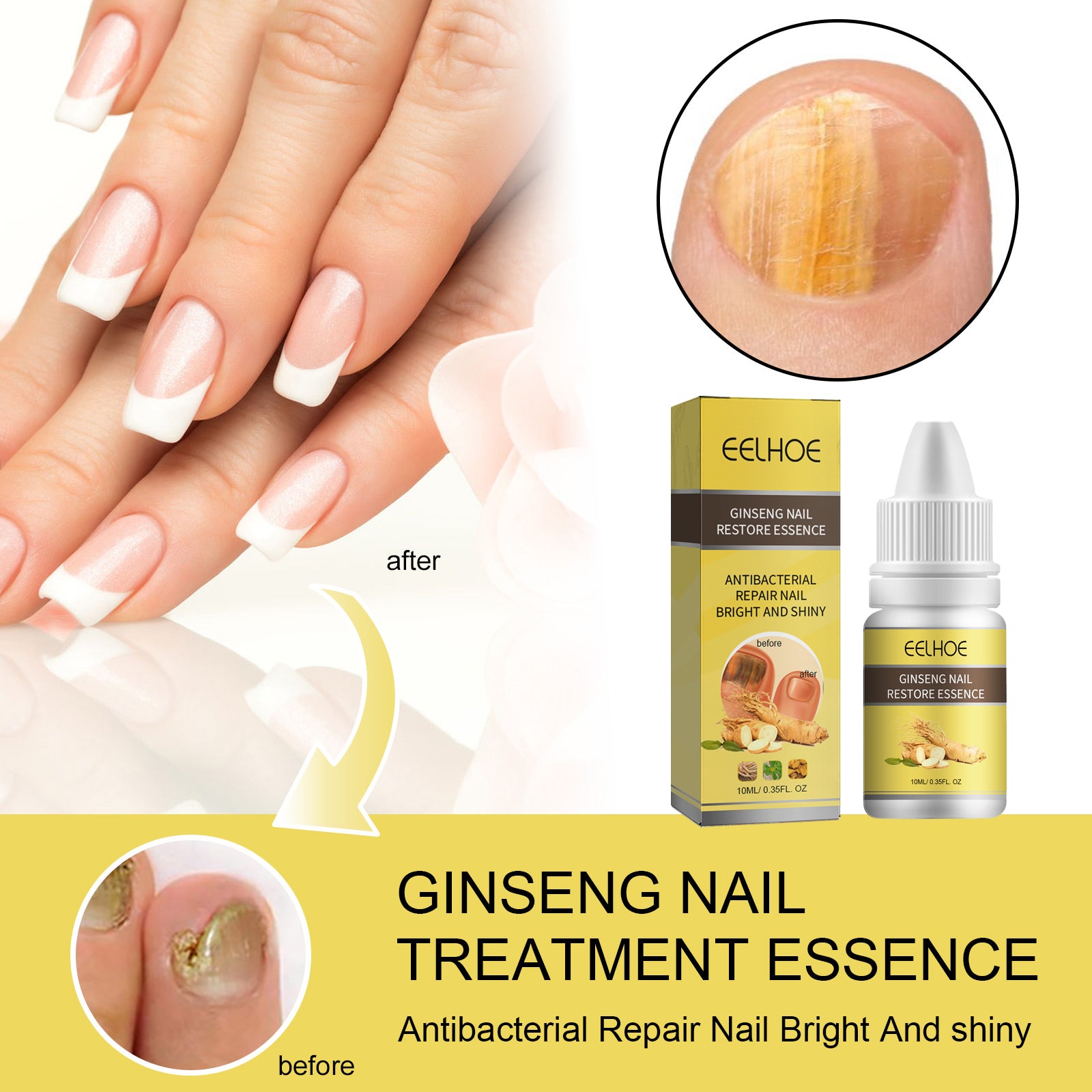 Ginseng Nail Essential Oil Grey Nail Thickening Nail Repair Brightening Nail Removing Soft Nail Moisturizing Essence Health Eprolo https://www.cyberehub.com