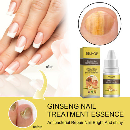 Ginseng Nail Essential Oil Grey Nail Thickening Nail Repair Brightening Nail Removing Soft Nail Moisturizing Essence Health Eprolo https://www.cyberehub.com