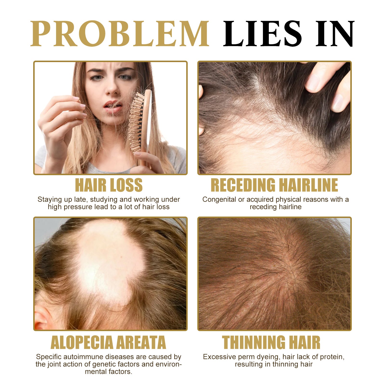 Ginseng Massage Essence, Moisturizes Scalp Strengthens Hair Prevents Loss Hair Care Essence Health Eprolo https://www.cyberehub.com