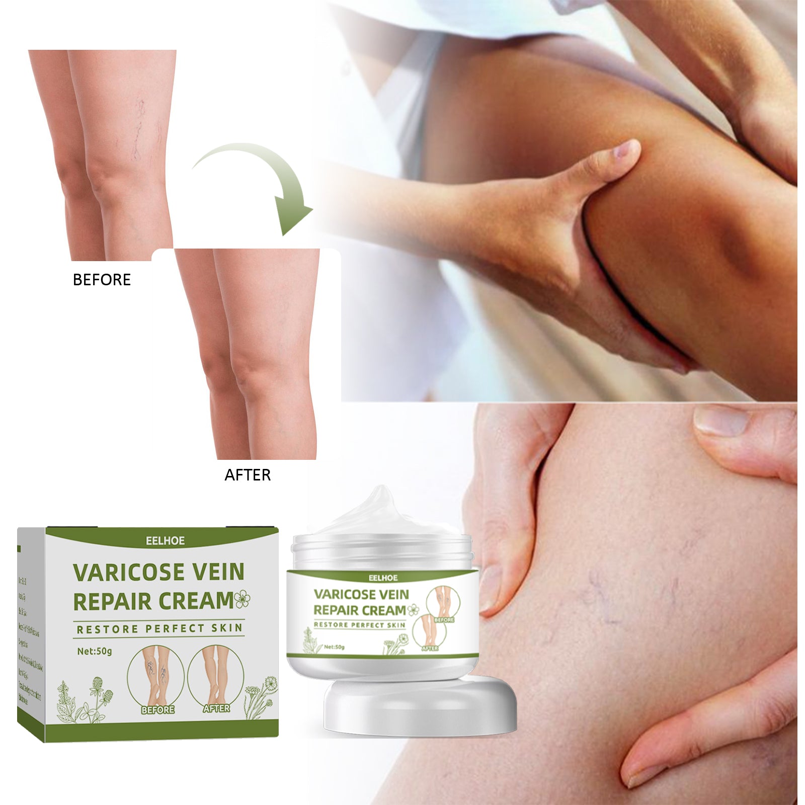 EELHOE Leg Repair Cream Relieves Leg Discomfort Massage Leg Repair Cream For Raised Veins Health & Beauty Health Eprolo https://www.cyberehub.com