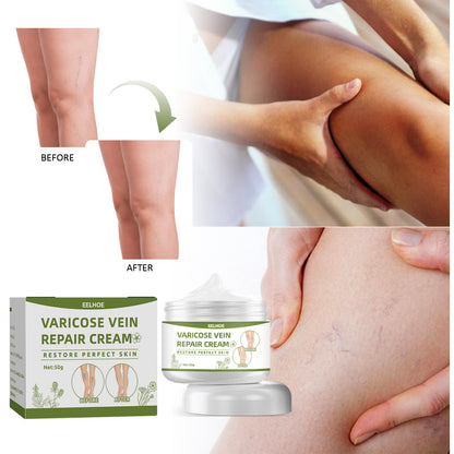 EELHOE Leg Repair Cream Relieves Leg Discomfort Massage Leg Repair Cream For Raised Veins Health & Beauty Health Eprolo https://www.cyberehub.com