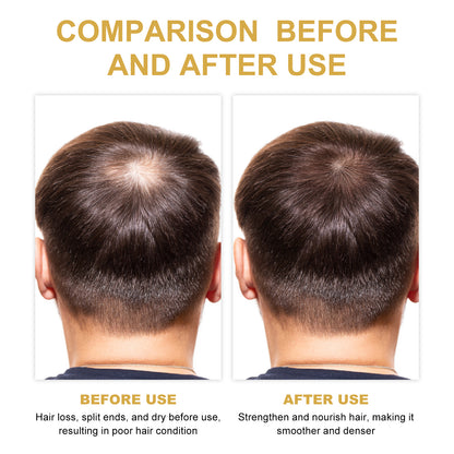 Hair Dense Oil, Scalp Cleaning Care Fluffy Soft Repair Dry Hair Impetuous Solid Hair Dense Hair Essential Oil Health Eprolo https://www.cyberehub.com