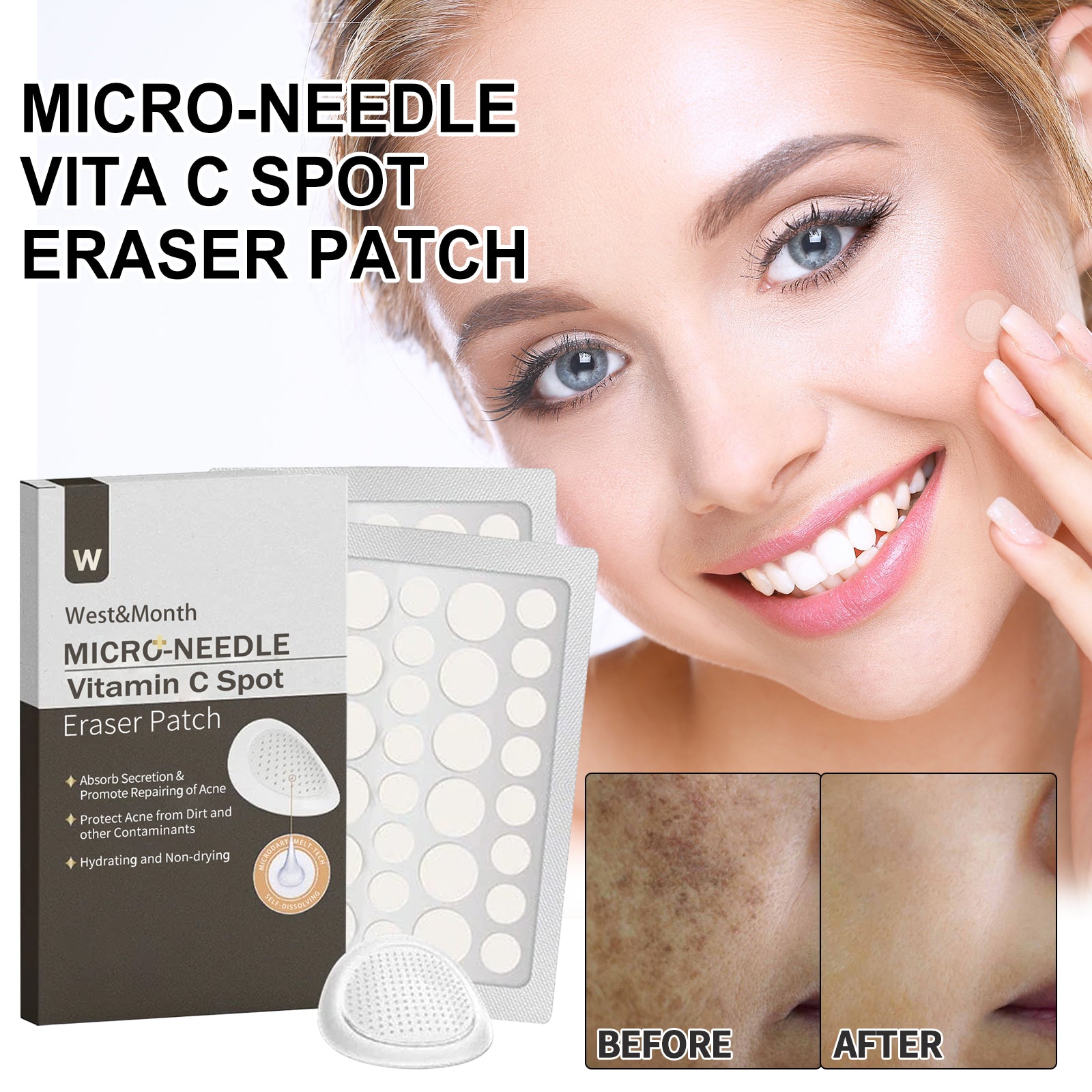 Micro-needle Vita C Spot Eraser Patch, Fade Spots Acne Print Blemishes Cover Spots Repair Patch Health Eprolo https://www.cyberehub.com