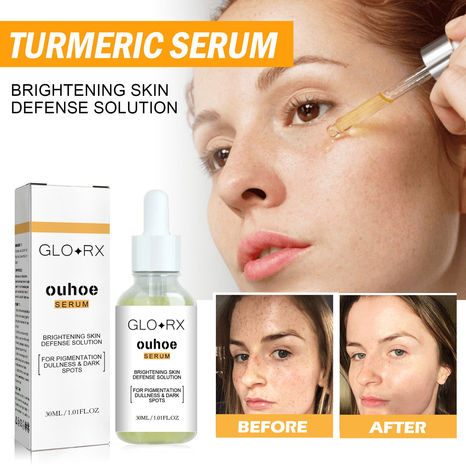 Turmeric Whitening Spot Serum, Lighten Freckle Spots Brightening Skin Hydrating Serum default title Health Eprolo https://www.cyberehub.com
