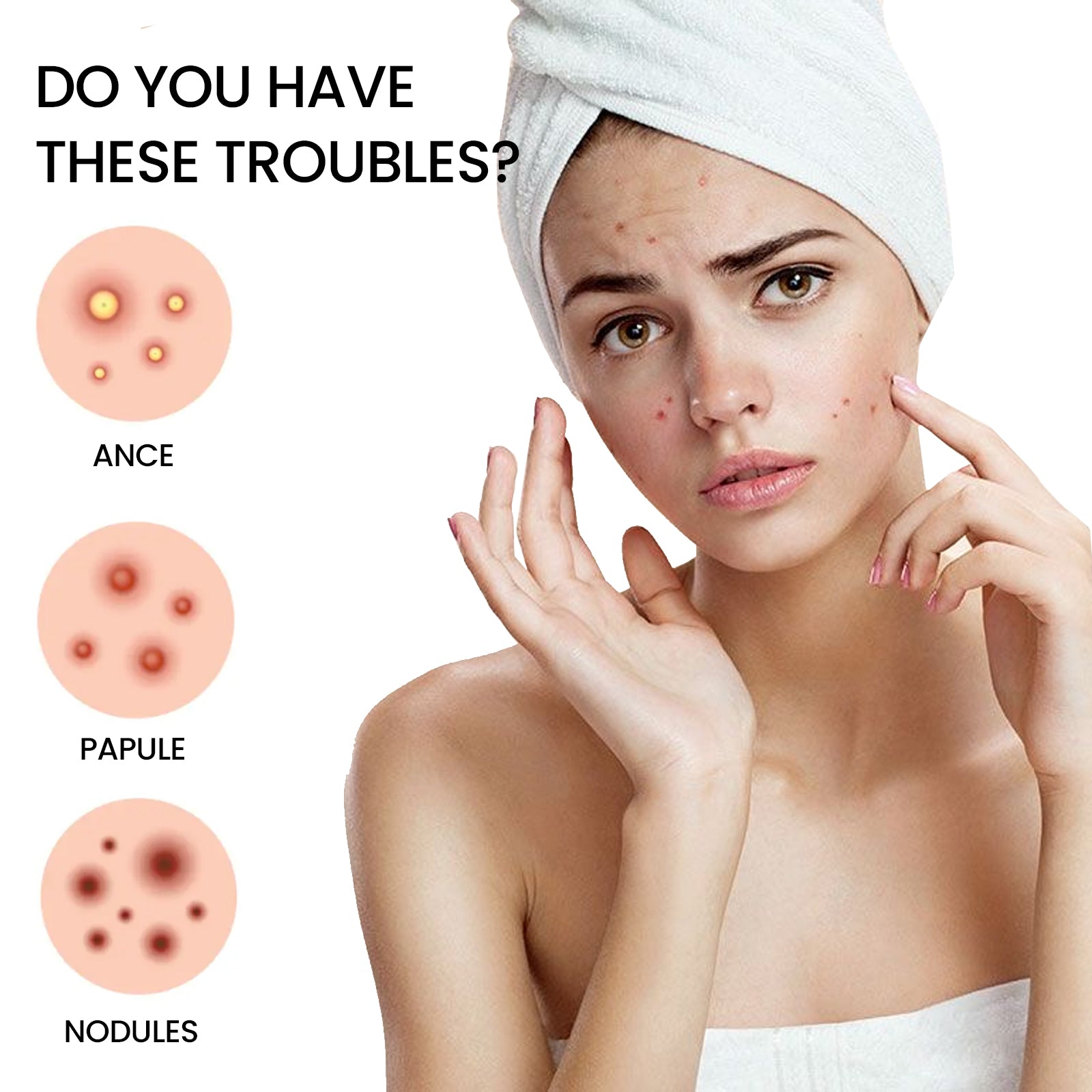 Jaysuing Pimples Patch, Repair Pockmarks Lighten Pimples Blemishes Cover Pimples Health Eprolo https://www.cyberehub.com