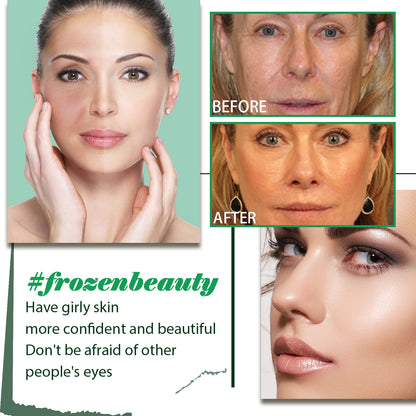 Hyaluronic Acid Anti-Wrinkle Essence Reduces Fine Lines And Moisturizes And Tightens Facial Skin Health Eprolo https://www.cyberehub.com