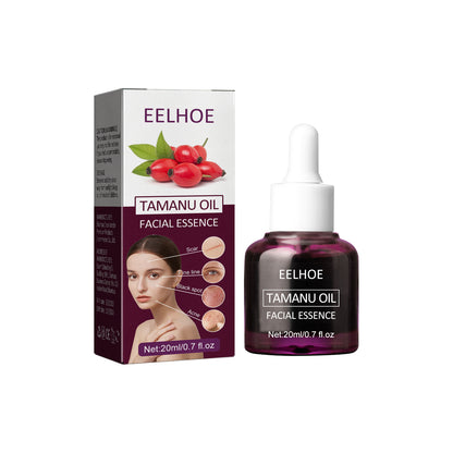 Tamanu Facial Oil, Relieves Acne Marks Fine Lines Moisturizes and Firms Skin Essential Oil Health Eprolo https://www.cyberehub.com