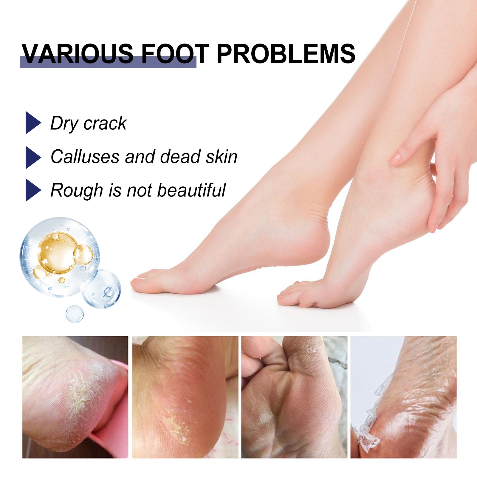 Cracked Heel Ointment, Repair Heel Calluses And Foot Moisturizing Anti-Cracking Peeling Care Health & Beauty Health Eprolo https://www.cyberehub.com