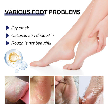 Cracked Heel Ointment, Repair Heel Calluses And Foot Moisturizing Anti-Cracking Peeling Care Health & Beauty Health Eprolo https://www.cyberehub.com