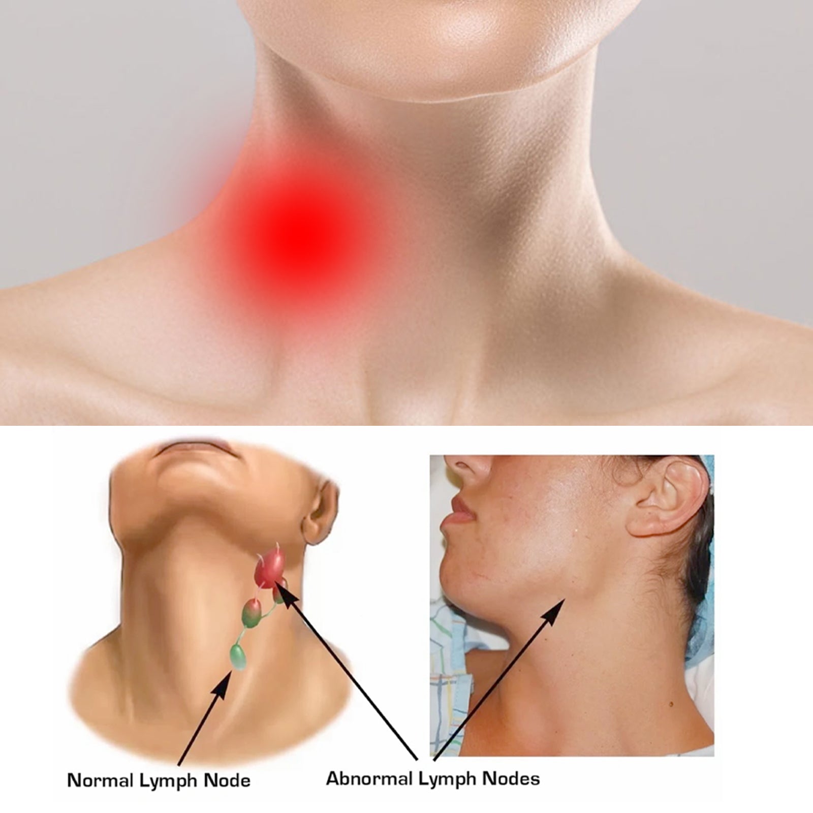 Neck Lymph Patch, Fade Lymph Relief Neck Meridians Neck Care Patch Health Eprolo https://www.cyberehub.com