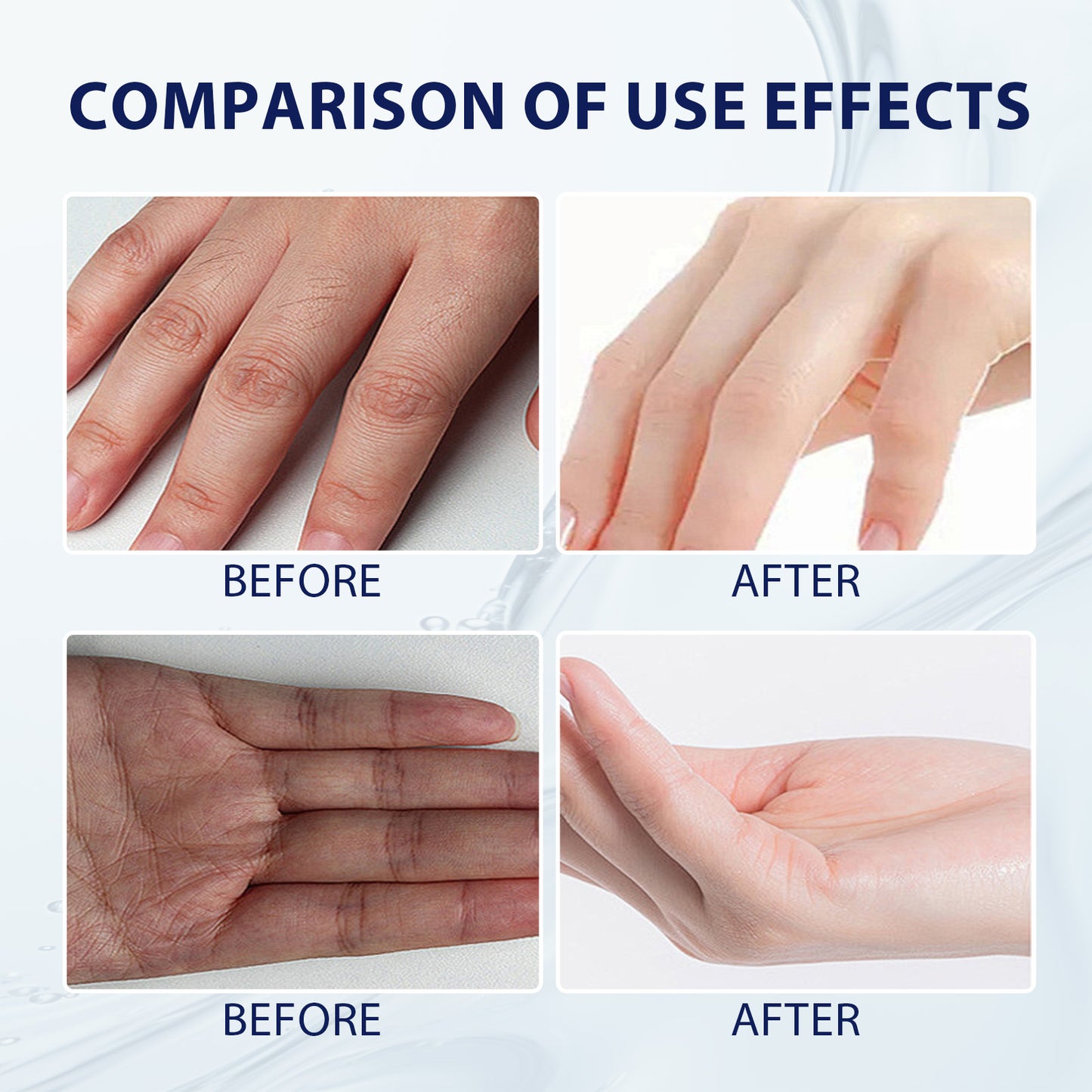 Aloe Vera Care Gel, Hydrating And Refreshing Moisturizing Cream Prevents Dryness And Cracks To Repair Hand Skin Health Eprolo https://www.cyberehub.com