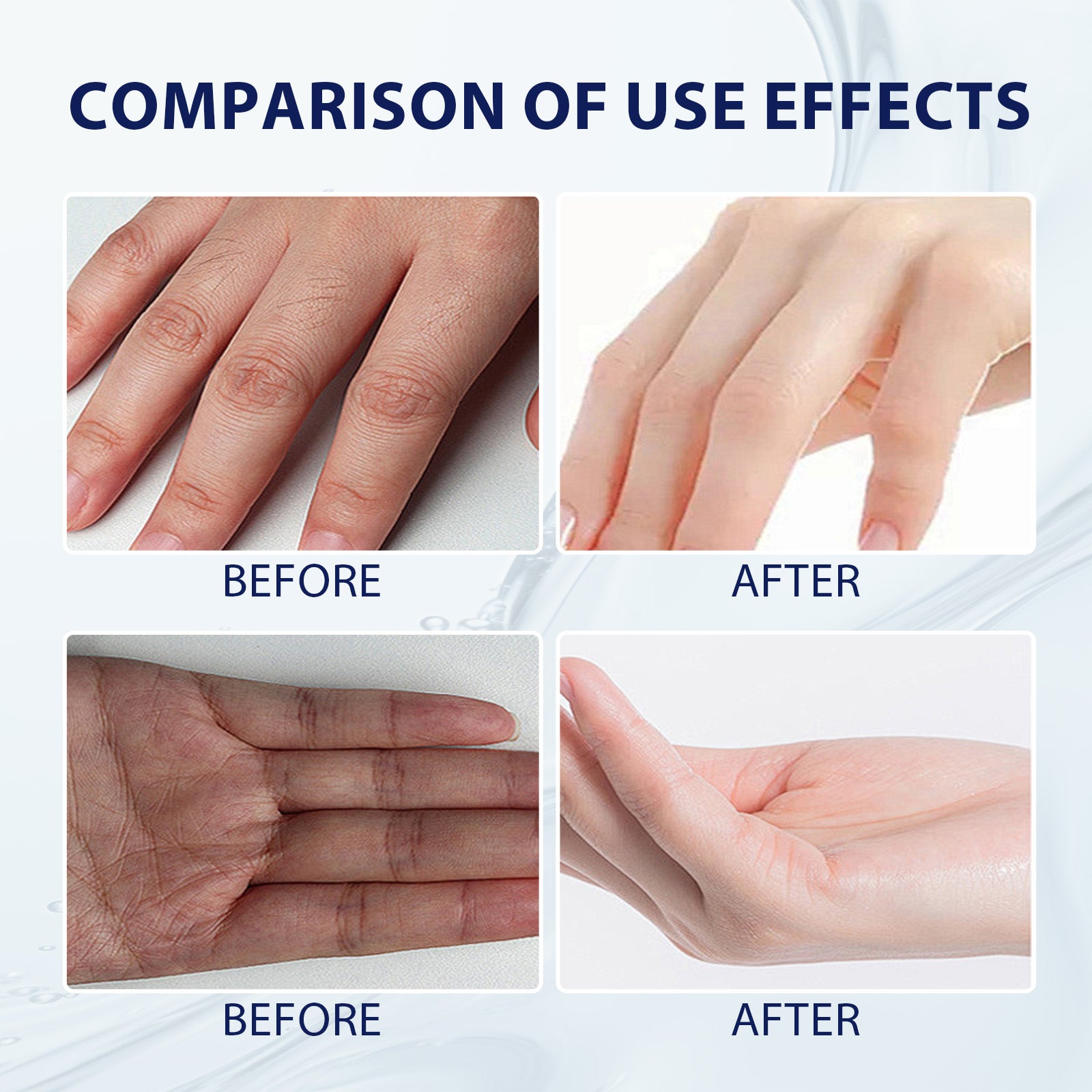 Aloe Vera Care Gel, Hydrating And Refreshing Moisturizing Cream Prevents Dryness And Cracks To Repair Hand Skin Health Eprolo https://www.cyberehub.com