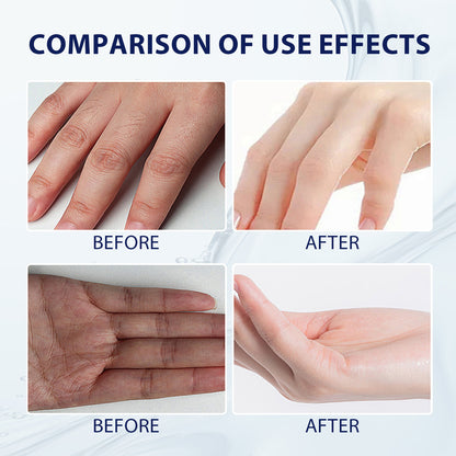 Aloe Vera Care Gel, Hydrating And Refreshing Moisturizing Cream Prevents Dryness And Cracks To Repair Hand Skin Health Eprolo https://www.cyberehub.com