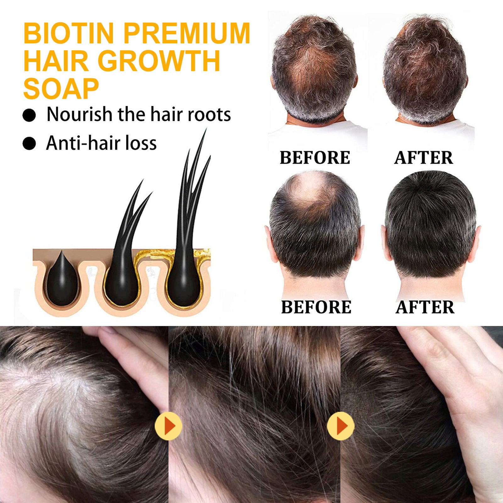 Biotin Premium Hair Growth Soap, Strong And Moisturizing Hair Root To Reduce Dryness Smooth Beautiful Clean Hair Soap Health & Beauty Health Eprolo https://www.cyberehub.com