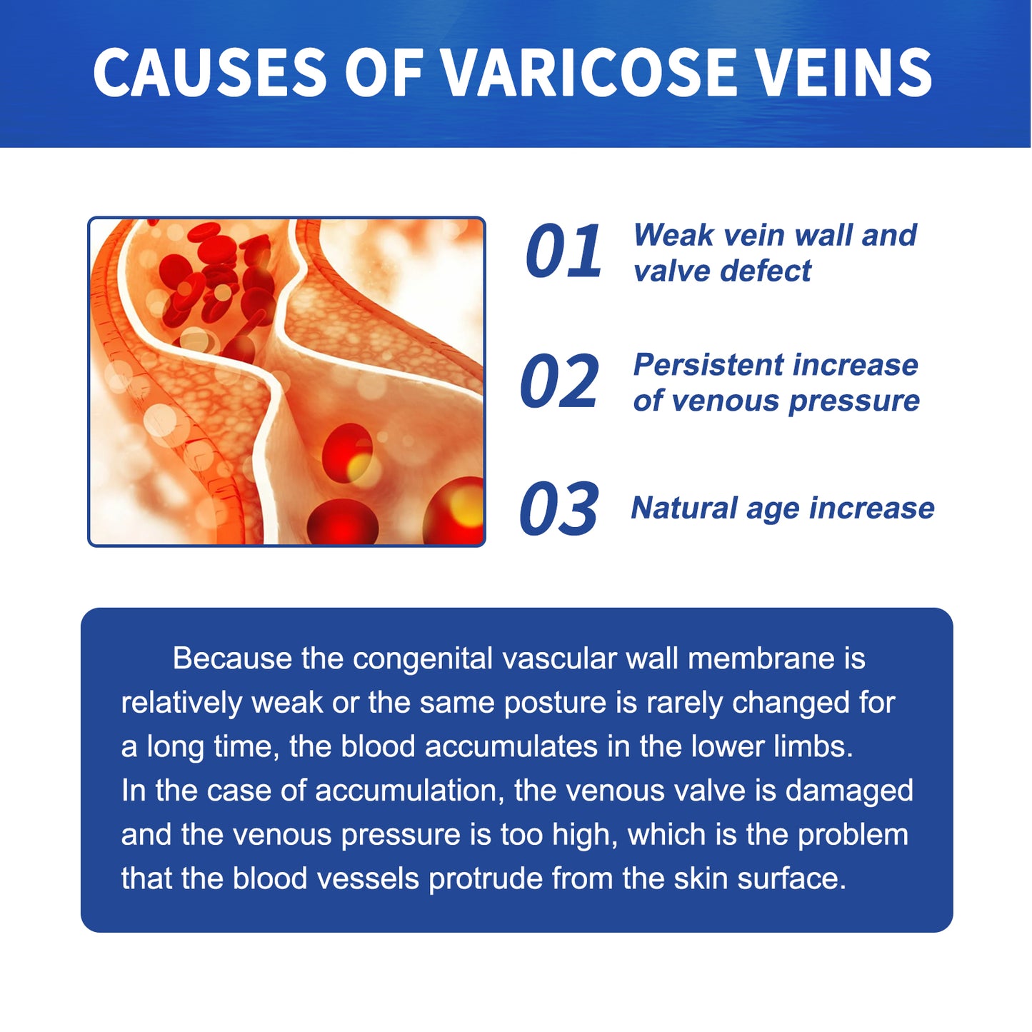 Vein Massage Varicose Cream Repair Earthworm Legs To Relieve Leg Blood Vessel Bulge And Varicoidea Health Eprolo https://www.cyberehub.com