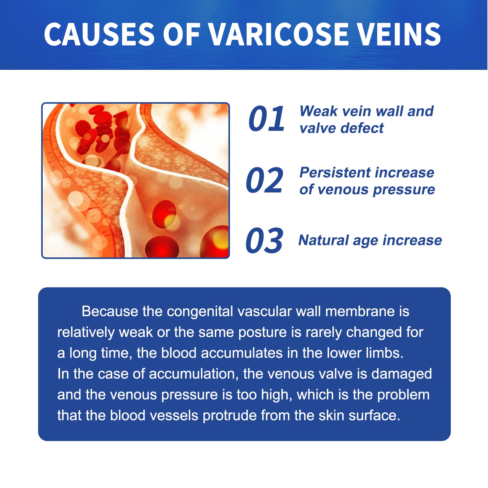 Vein Massage Varicose Cream Repair Earthworm Legs To Relieve Leg Blood Vessel Bulge And Varicoidea Health Eprolo https://www.cyberehub.com