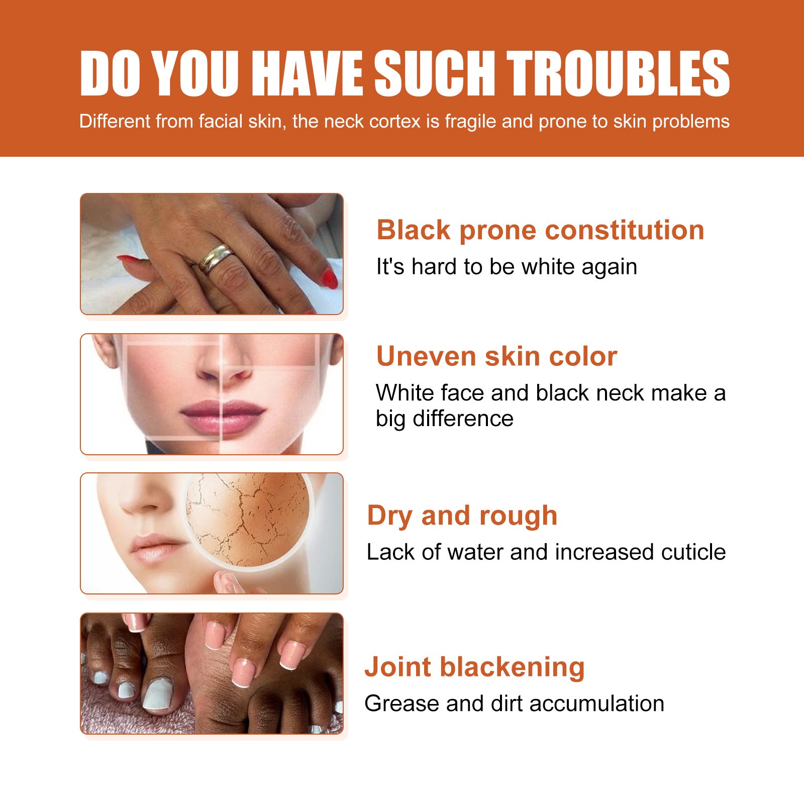 Skin Blackening Essence Brightening Knee Ankle Horn Melanin Removing Moisturizing Essence Health & Beauty Health Eprolo https://www.cyberehub.com