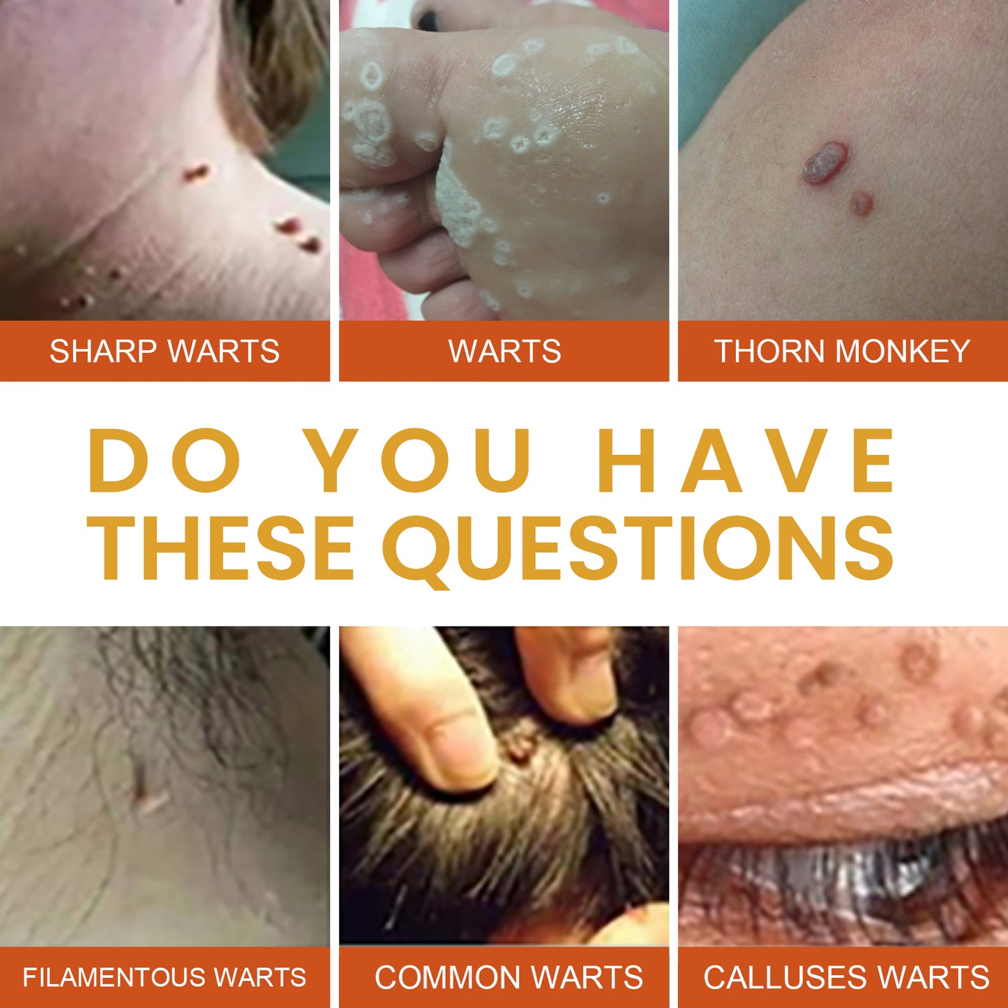 Anti-wart Essence, Anti Warts Fade Moles Corns Smoothing Skin Care Essence Health Eprolo https://www.cyberehub.com