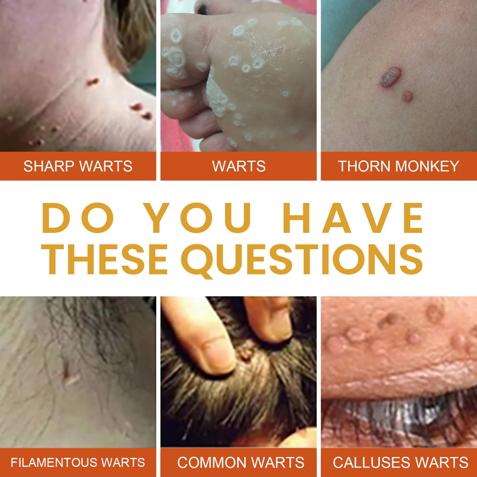 Anti-wart Essence, Anti Warts Fade Moles Corns Smoothing Skin Care Essence Health Eprolo https://www.cyberehub.com