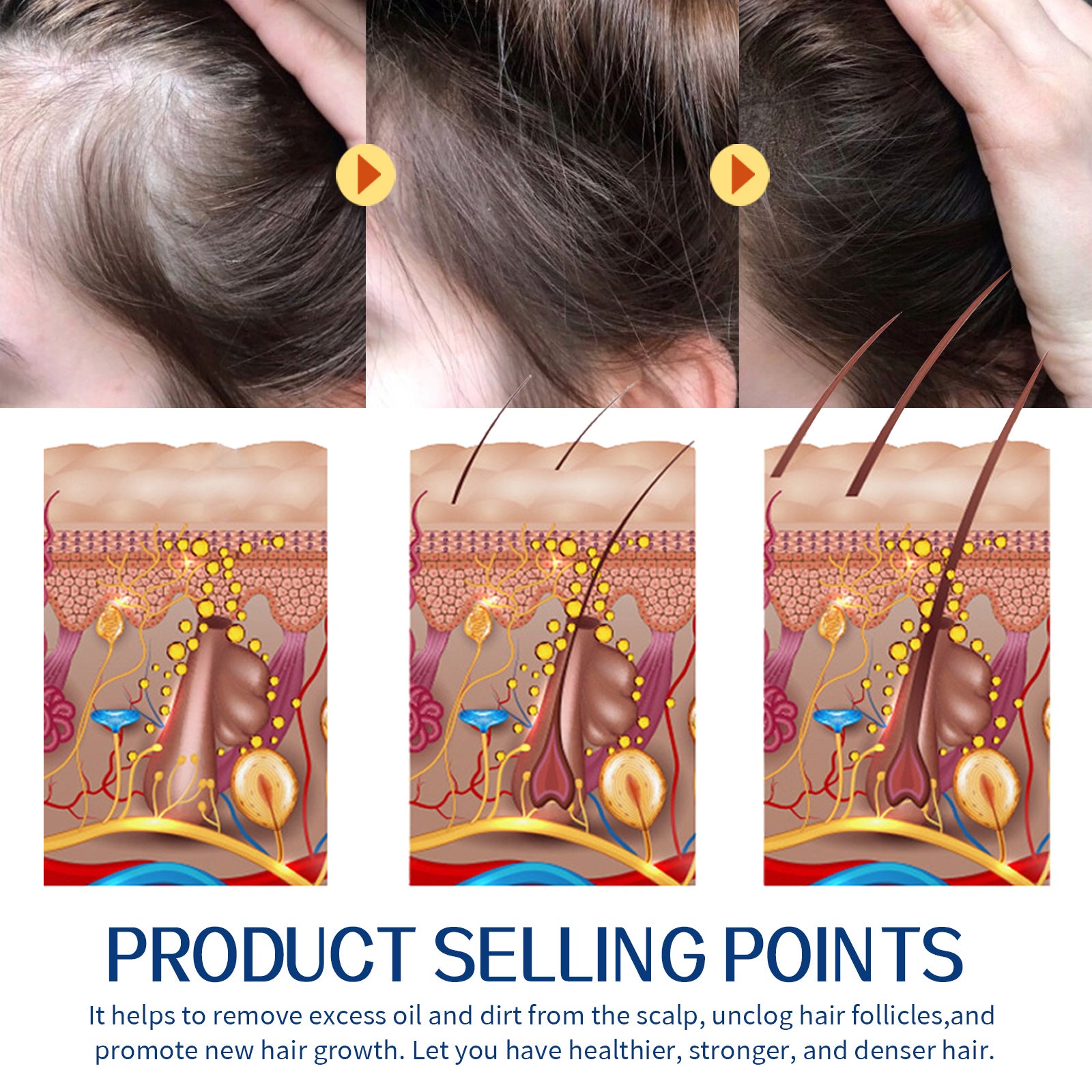 Hair Scrub Cleans Scalp Dandruff, Soothes Itchiness, Moisturizes Dense, Firming, And Prevents Hair Loss Health Eprolo https://www.cyberehub.com