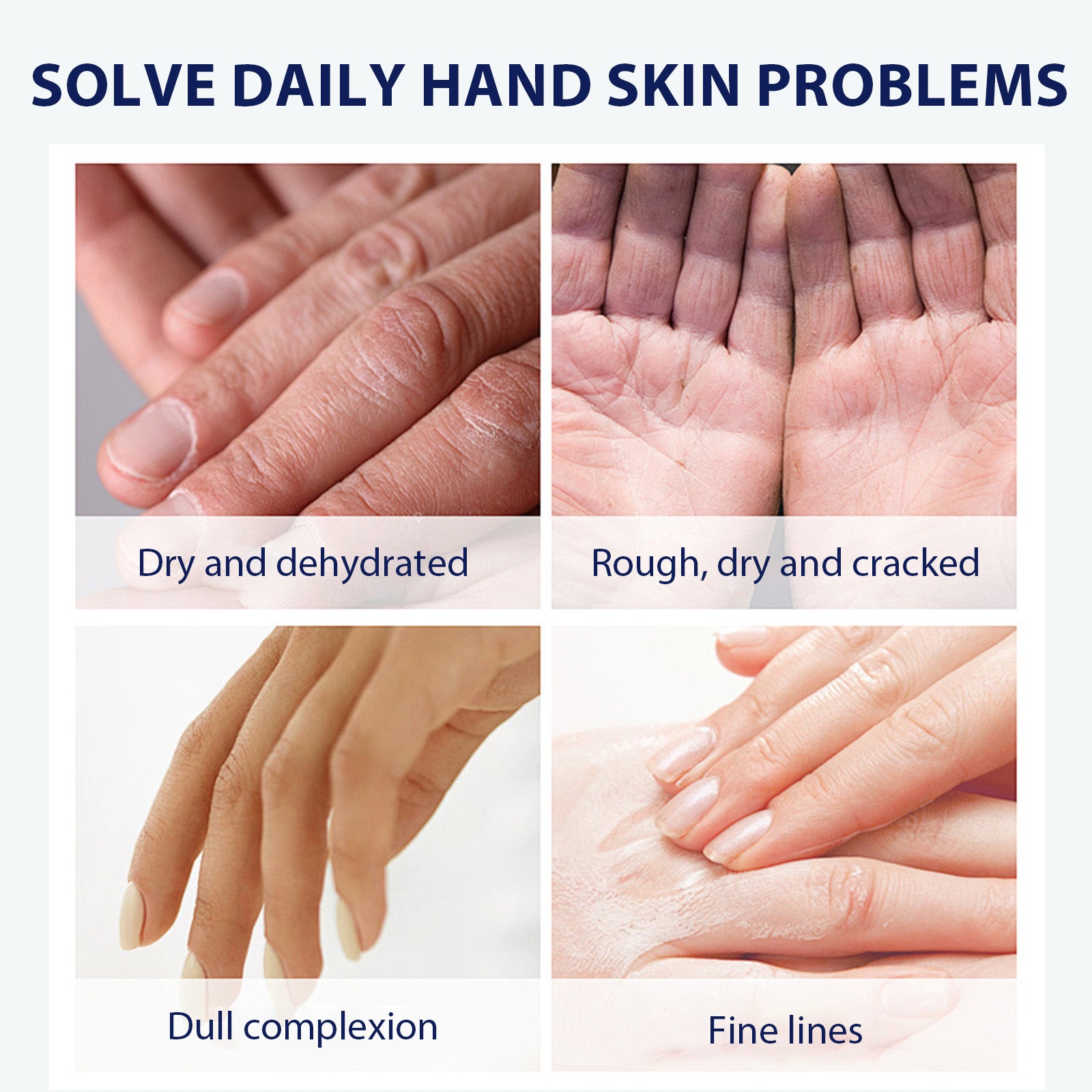 Aloe Vera Care Gel, Hydrating And Refreshing Moisturizing Cream Prevents Dryness And Cracks To Repair Hand Skin Health Eprolo https://www.cyberehub.com