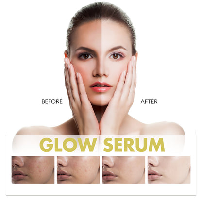 Glow Serum, Moisturizing And Whitening Skin To Reduce Facial Spots And Fine Lines Health Eprolo https://www.cyberehub.com