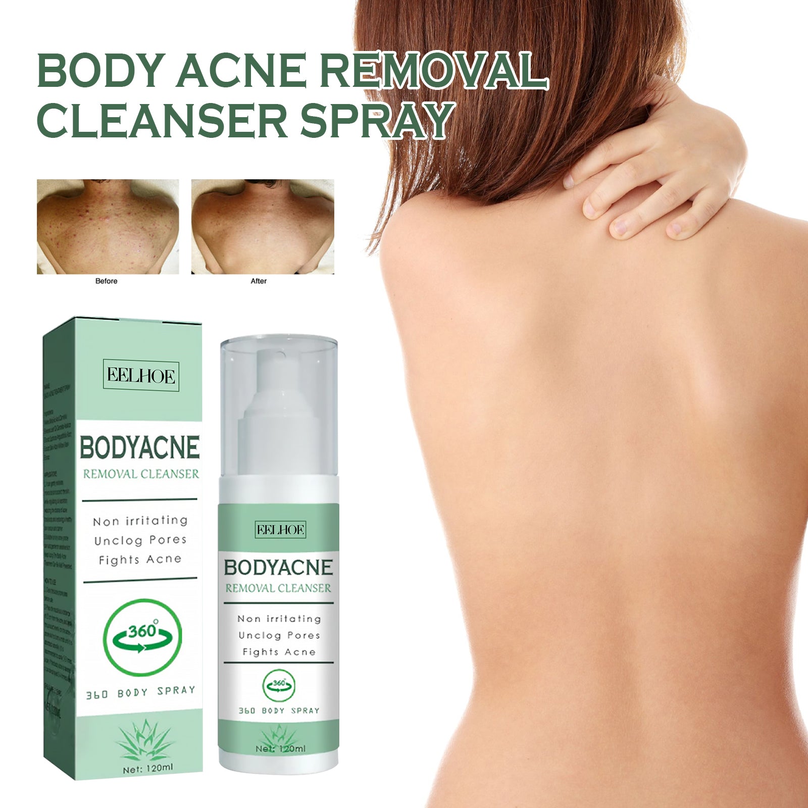 Body Acne Removal Cleanser Spray, Deep Clean Back Arm Fade Acne Beauty Moisturizing Spray Health & Beauty Health Eprolo https://www.cyberehub.com