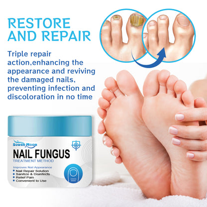 Nail Fungus Treatment Method, Repair Grey Nail Brightening Nail Thickening Nail Hand And Foot Nails Moisturizing Care Cream Health Eprolo https://www.cyberehub.com