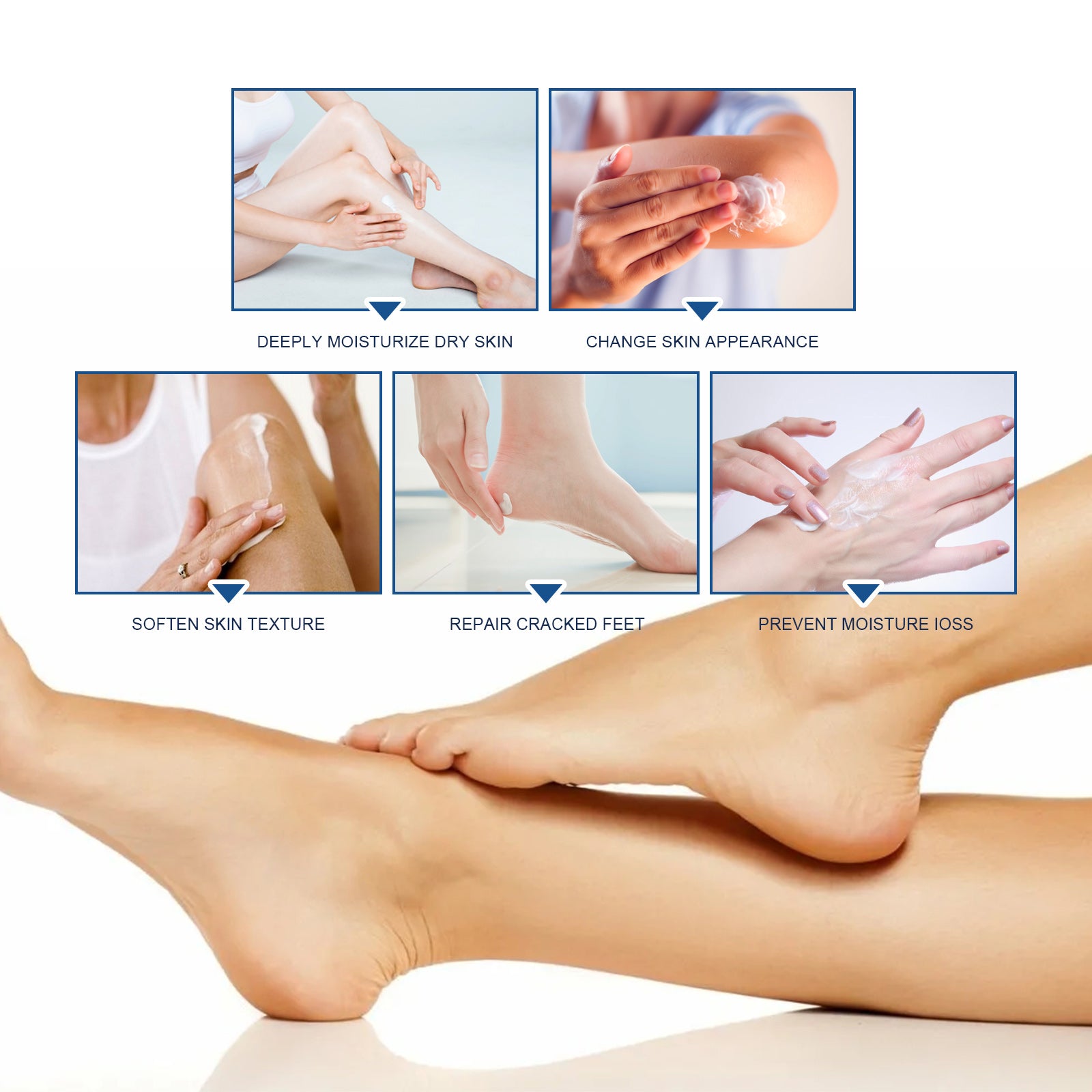 Body Repair Cream, Relieve Peeling Improve Chapped Dry Skin And Remove Dead Skin Moisturize Cream Health Eprolo https://www.cyberehub.com