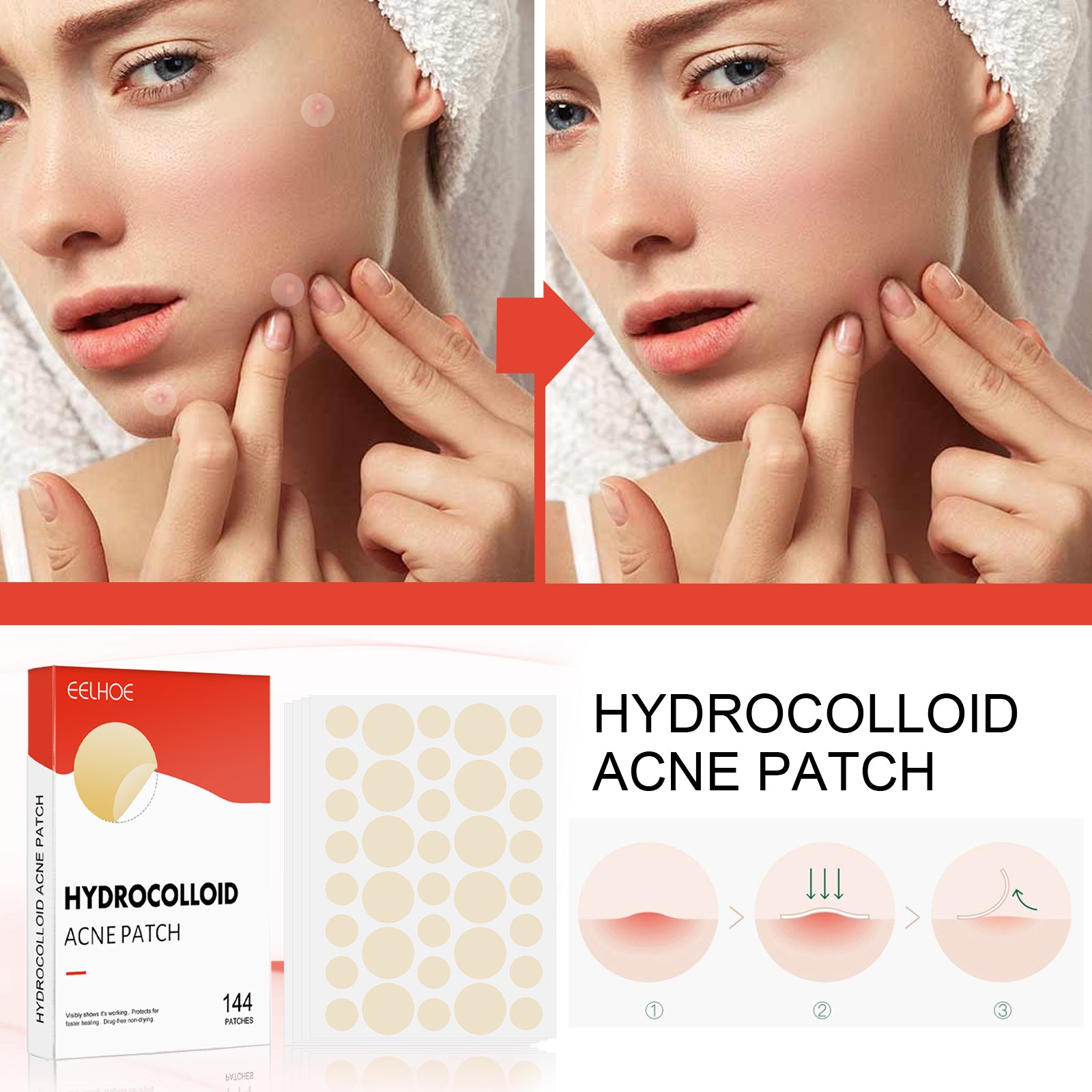 Hydrocolloid Acne Patch Face Invisible Makeup Closed Mouth Acne Clear Acne Waterproof Breathable Facial Treatment Health Eprolo https://www.cyberehub.com