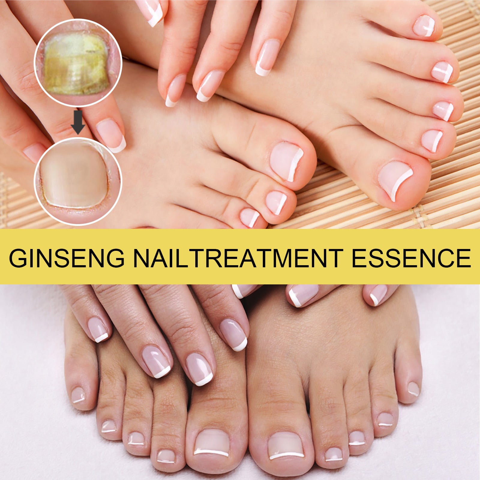 Ginseng Nail Essential Oil Grey Nail Thickening Nail Repair Brightening Nail Removing Soft Nail Moisturizing Essence Health Eprolo https://www.cyberehub.com