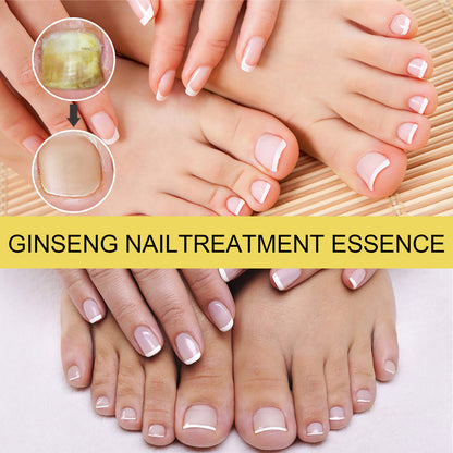 Ginseng Nail Essential Oil Grey Nail Thickening Nail Repair Brightening Nail Removing Soft Nail Moisturizing Essence Health Eprolo https://www.cyberehub.com