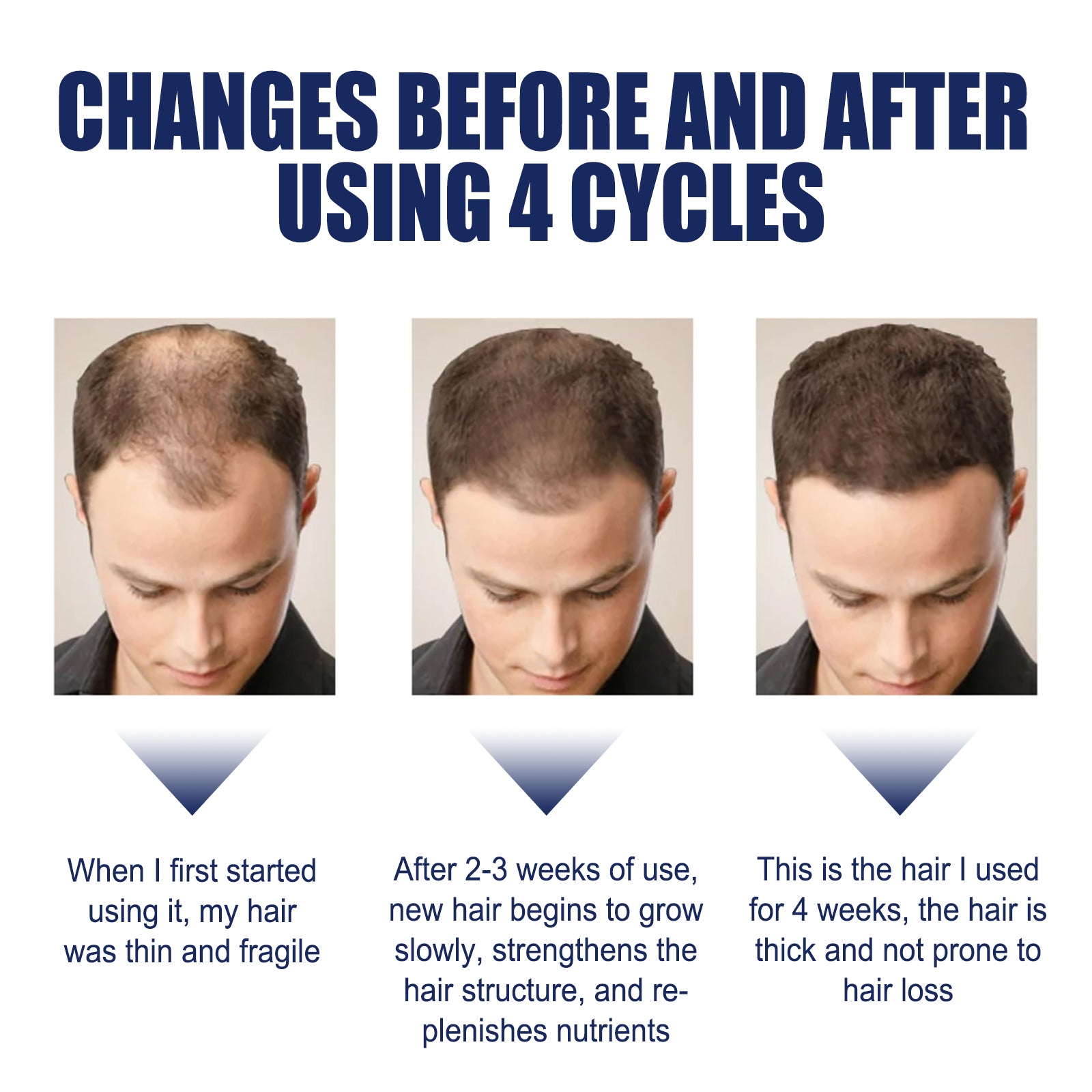 Herbal Hair Care Essential Oil Hair Care Strengthen Hair, Prevent Hair Loss, Repair Hair Root Care Essential Oil Health Eprolo https://www.cyberehub.com