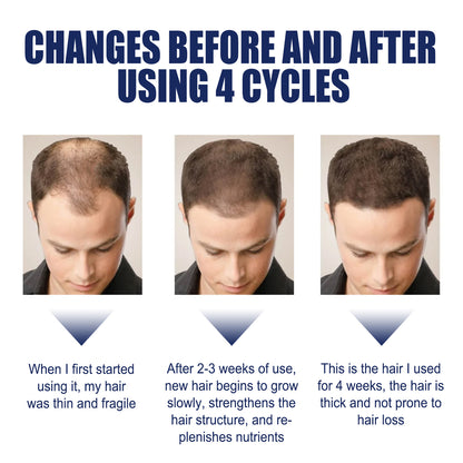 Herbal Hair Care Essential Oil Hair Care Strengthen Hair, Prevent Hair Loss, Repair Hair Root Care Essential Oil Health Eprolo https://www.cyberehub.com