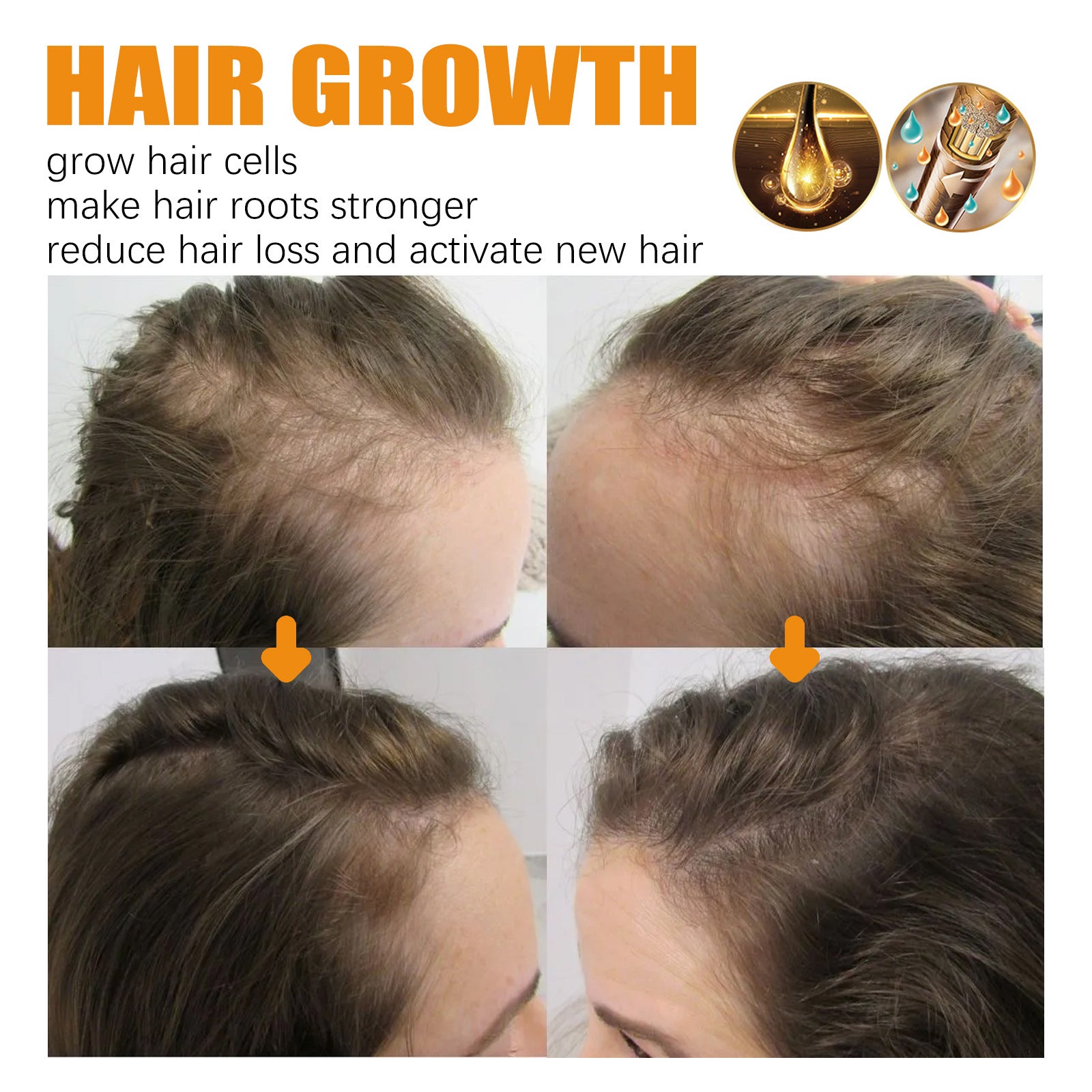 Biotin Shampoo Scalp Cleansing Gently Nourishes Hair Moisturizing Smooth And Glossy Shampoo Health & Beauty Health Eprolo https://www.cyberehub.com