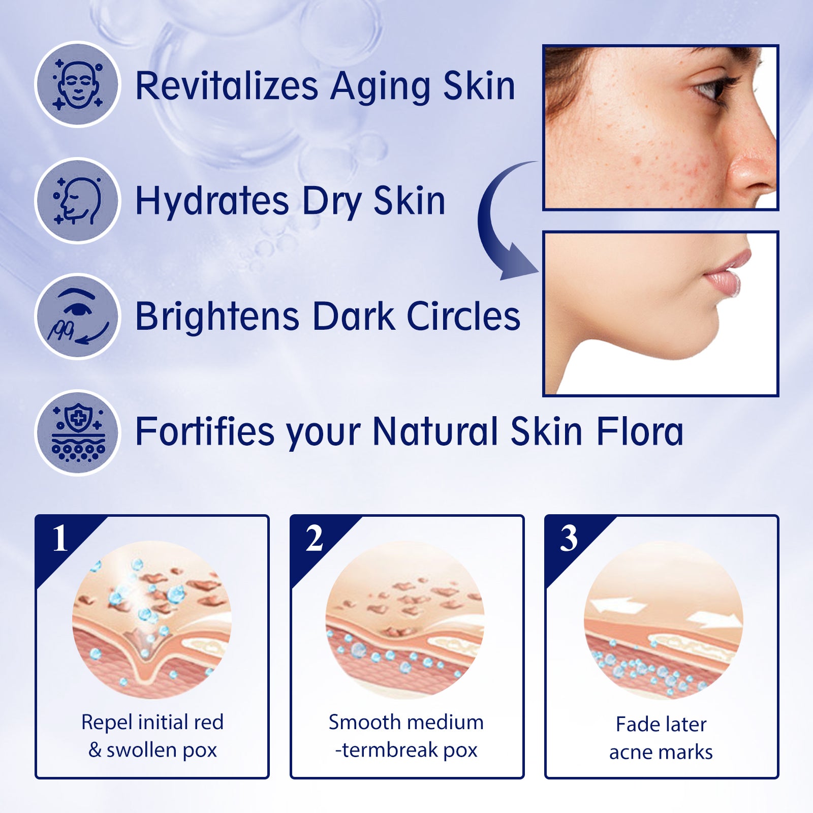 Anti-aging Vitamin C Facial Essence, Reduces Spots Acne Fine Lines, Moisturizes Facial Essence Health Eprolo https://www.cyberehub.com