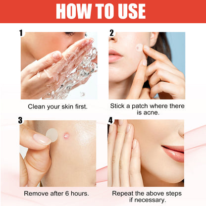 Hydrocolloid Acne Patch Face Invisible Makeup Closed Mouth Acne Clear Acne Waterproof Breathable Facial Treatment Health Eprolo https://www.cyberehub.com