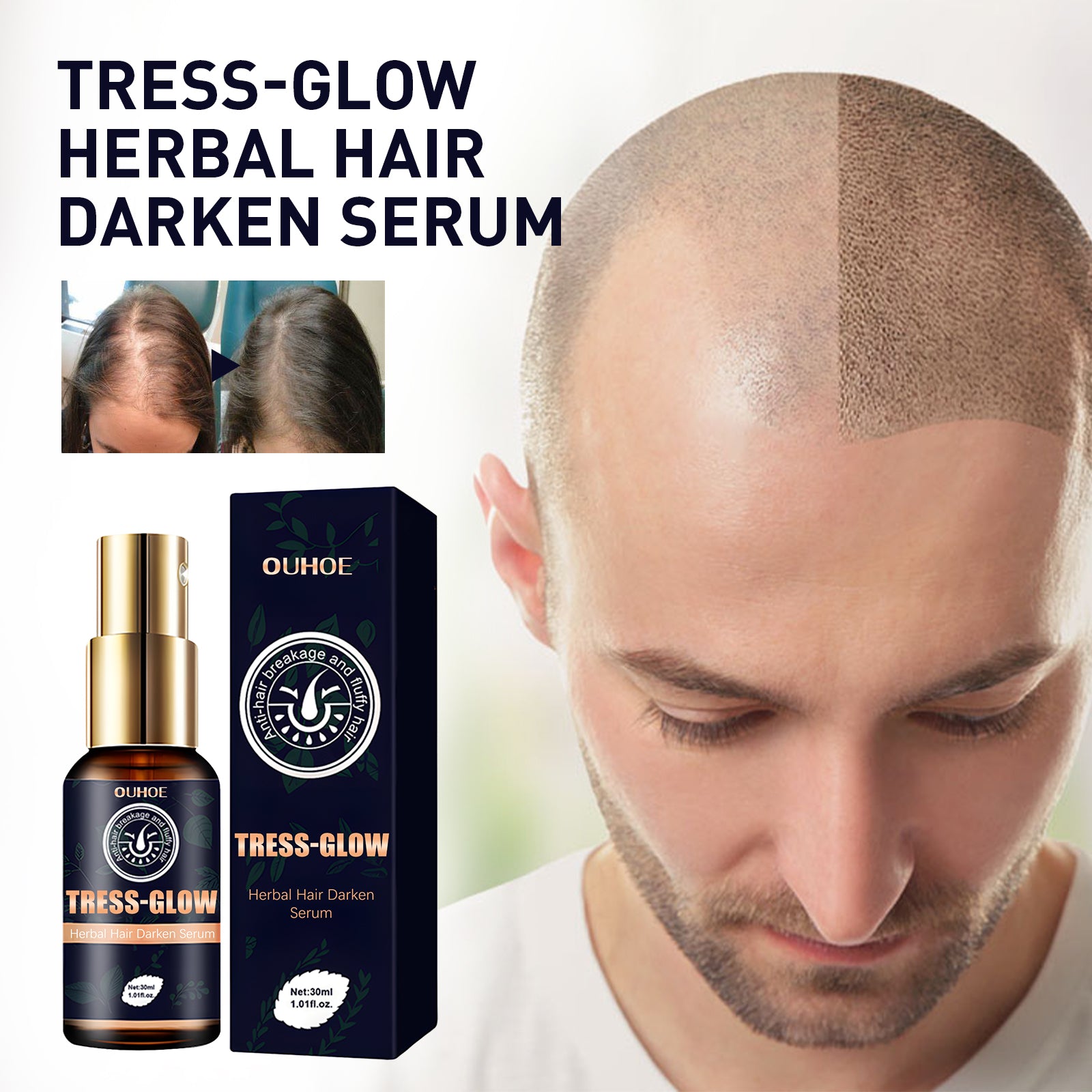 Herbal Hair Essence, Moisturizes Scalp Strong Hair Roots Thick Beard Care Essence Health Eprolo https://www.cyberehub.com
