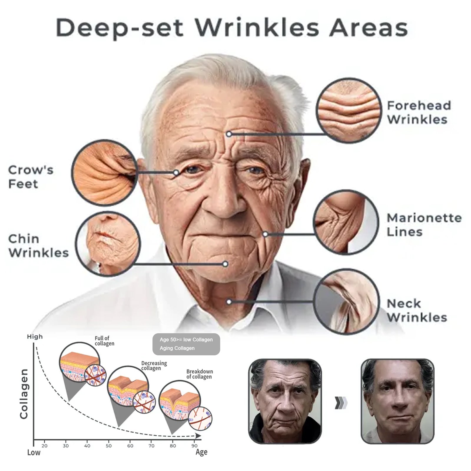For Men Collagen Cream, Lighten Fine Lines Moisturizing Firming Skin Whitening Brightening Cream Health Eprolo https://www.cyberehub.com