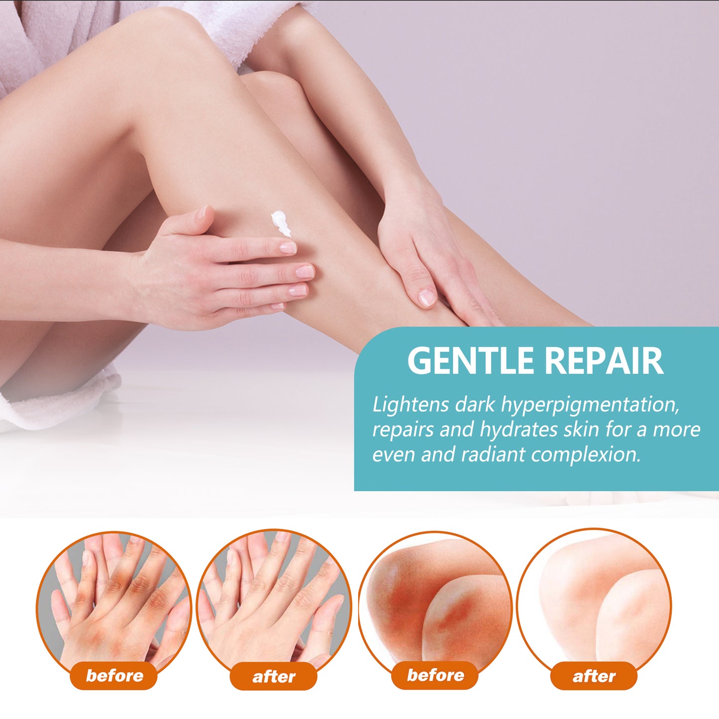 Black Acanthoderm Repair Cream Repair Underarm Arm Knee Joint Black Moisturizing Whitening Body Care Cream Health Eprolo https://www.cyberehub.com