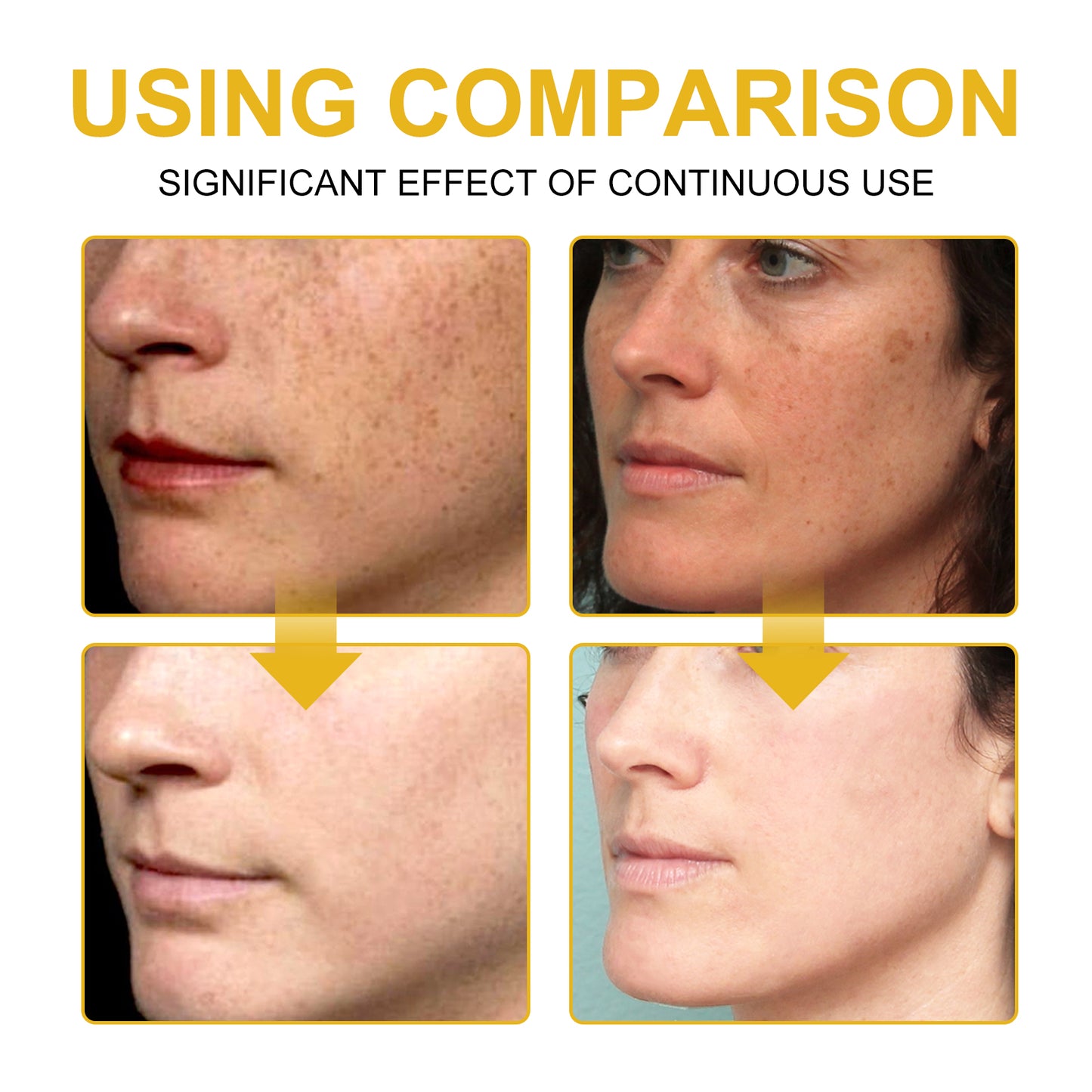 V7 Whitening Cream Reduces Wrinkles And Fine Lines On The Face, Moisturizes And Brightens Skin, Anti-Aging And Replenishing Cream Health Eprolo https://www.cyberehub.com
